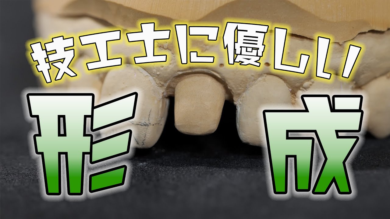 歯科技工士が作りやすい形成とは！？