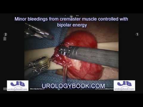 Natural Treatment For Urethral Stricture Natural Treatment For Urethral Stricture