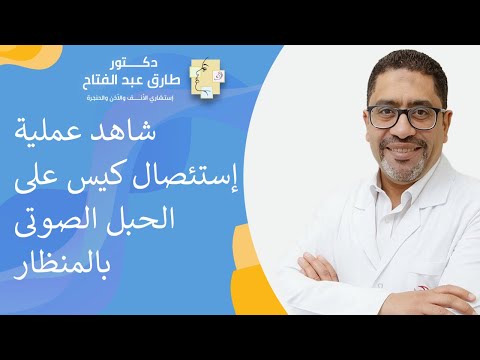 شاهد عملية إستئصال كيس على الحبل الصوتى بالمنظار