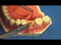 Learn to suture the easy way  surgical technique  interrupted buccal suturing  dental  medical