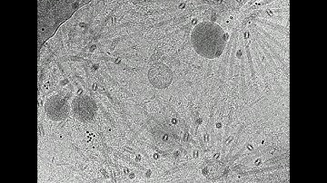 Cryo-Electron Microscopy