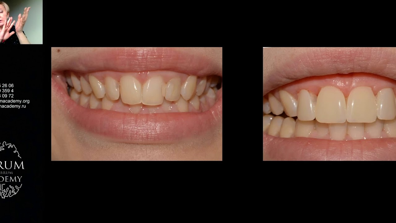 Превью Жанна Липкинд.Мотивация пациентов к реализации комплексных планов с использованием компониров