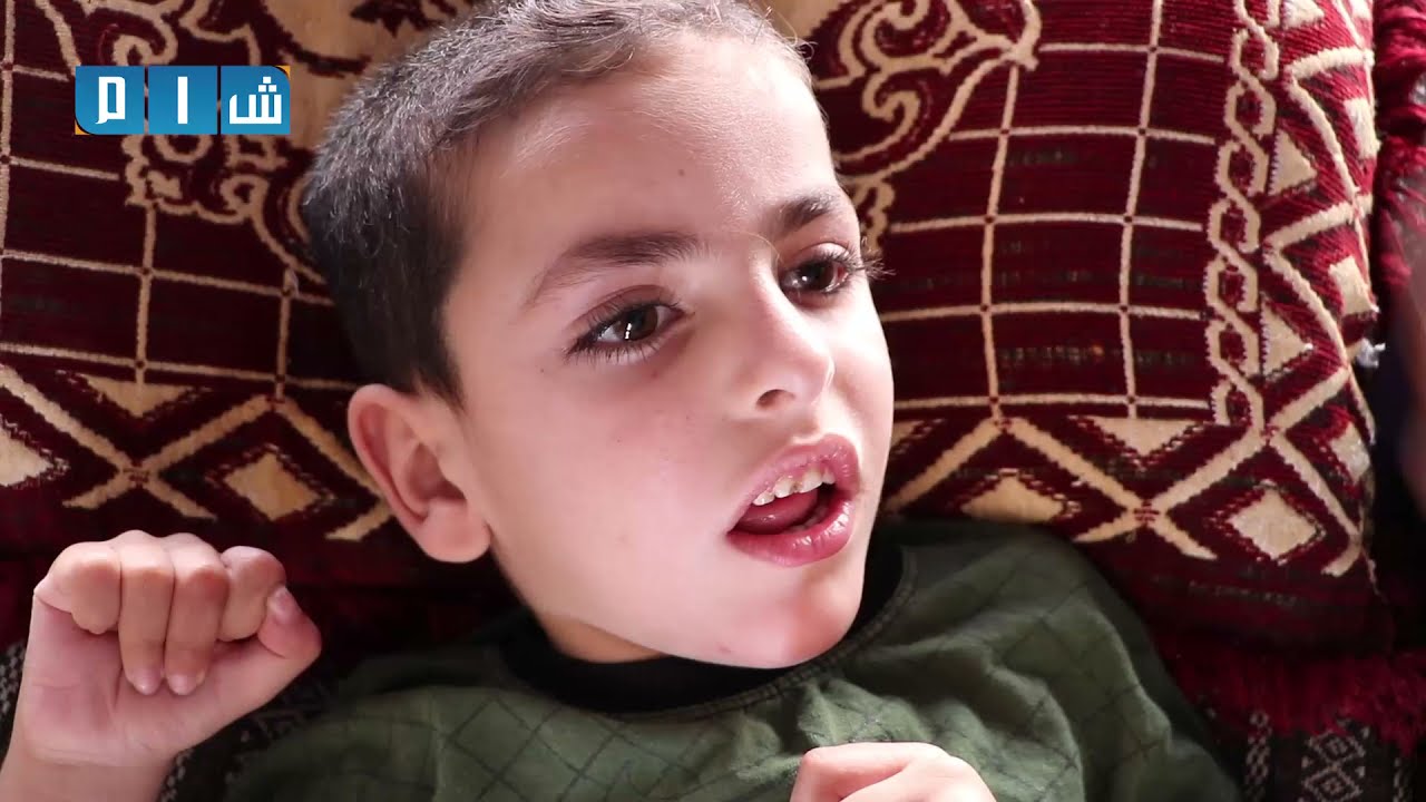 مأساة طفلين شقيقين يعانيان من الضمور الدماغي وسط معاناة عائلتها من التهجير والفقر