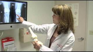 Jennifer van Warmerdam, M.D., Orthopaedic Surgery - Brown & Toland Physicians