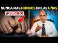 Elimina el Hongo de las Uñas en 3 Días con Este Remedio Casero Increíble!