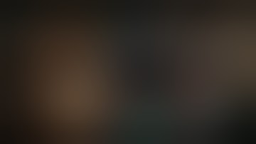 Robotic combined distal pancreatectomy and partial hepatectomy | Narrated video description