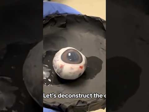 artificial Eye#anatomy