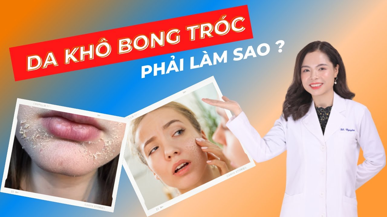 sao da 2022 Update Da khô bong tróc phải làm sao? 5 Mẹo khắc phục da khô hiệu quả | Bác sĩ Nguyên