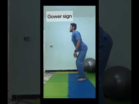 ٣ علامات لضمور العضلات