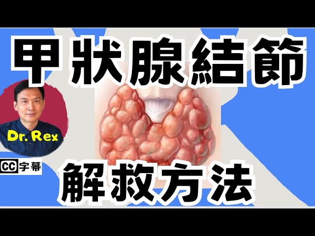 如何改善甲狀腺結節？ 什麼病徵顯示甲狀腺結節是腫瘤？ class=