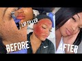 SKIN GAME CHANGER : THE FACIAL YOU NEVER KNEW YOU NEEDED  KIRAH OMINIQUE