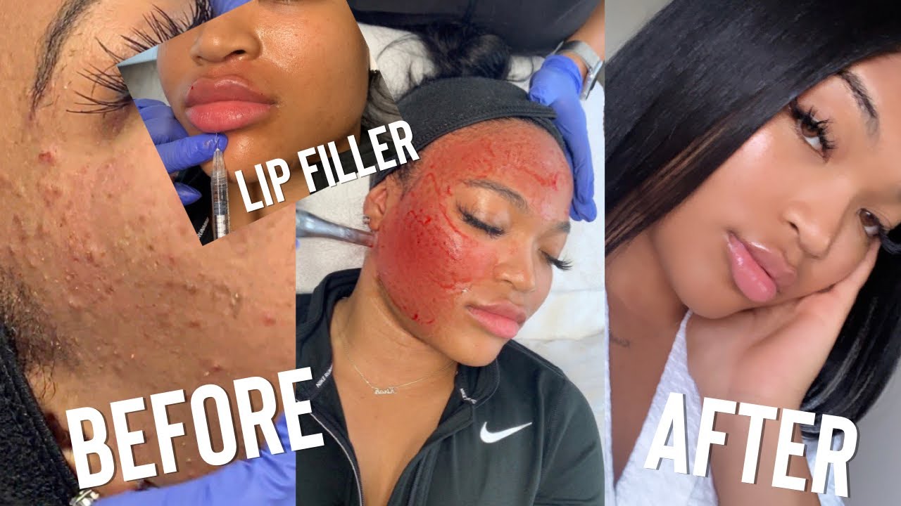 SKIN GAME CHANGER : THE FACIAL YOU NEVER KNEW YOU NEEDED  KIRAH OMINIQUE