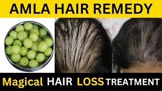 Amla Series 4 Amla Hair Mask for Hair Fall Amla Powder Regrow Hair Naturally White Hair to Black