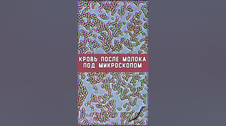 Молоко: что стало с кровью под микроскопом #эксперименты #наука #зож