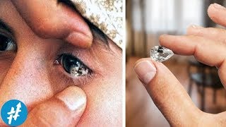 Mengejutkan! Tangisan GADIS Ini Bisa Keluarin PERMATA ASLI