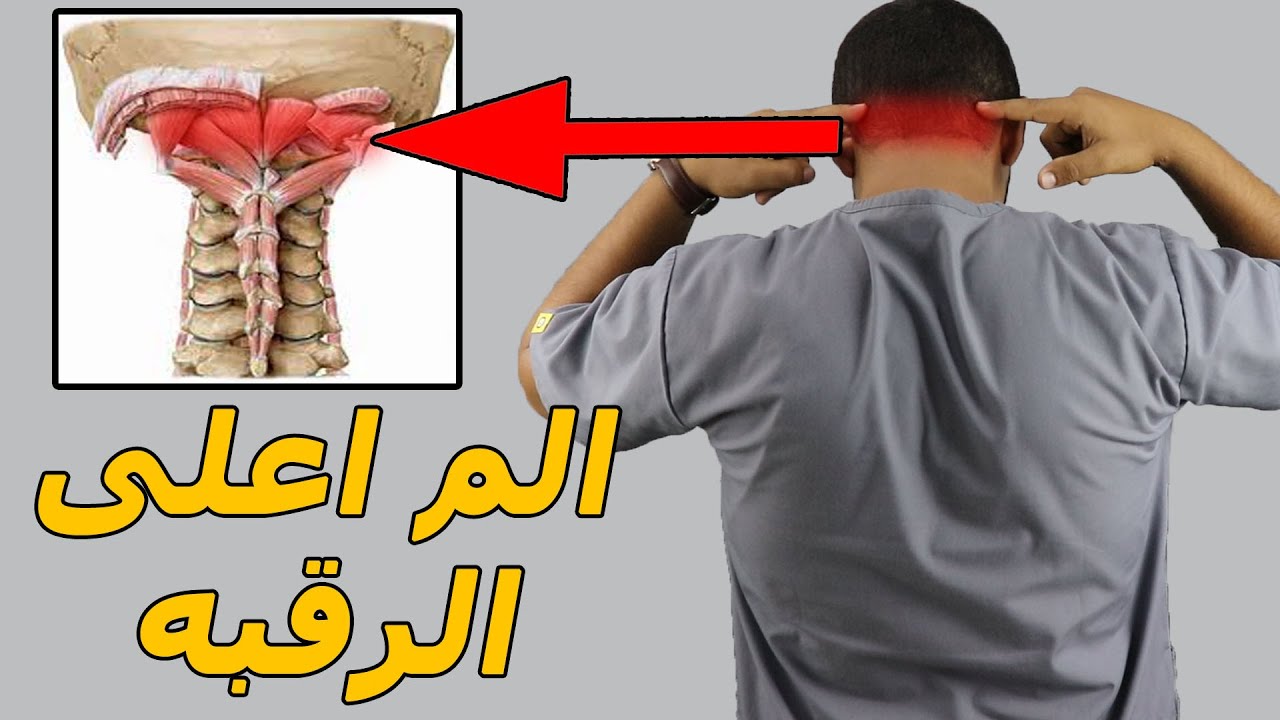 الم اعلى الرقبه من الخلف والراس  الاسباب والعلاج بتمارين منزليه بسيطه/علاج الم وشد الرقبه والصداع