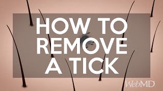 How to Remove a Tick | WebMD Details