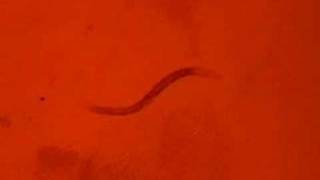 Celebrity Transgenic worm swimming Net Worth