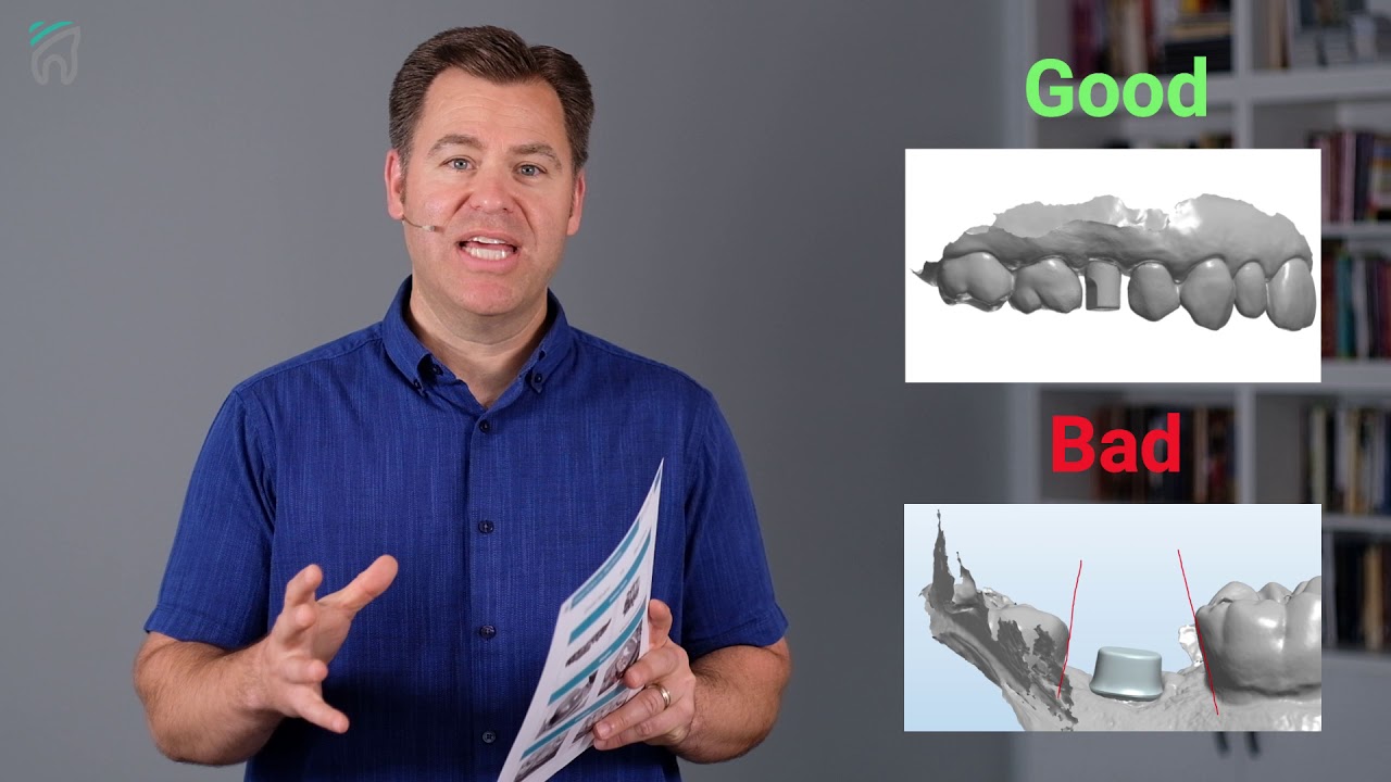 DDL: Good Scans vs. Bad Scans - YouTube