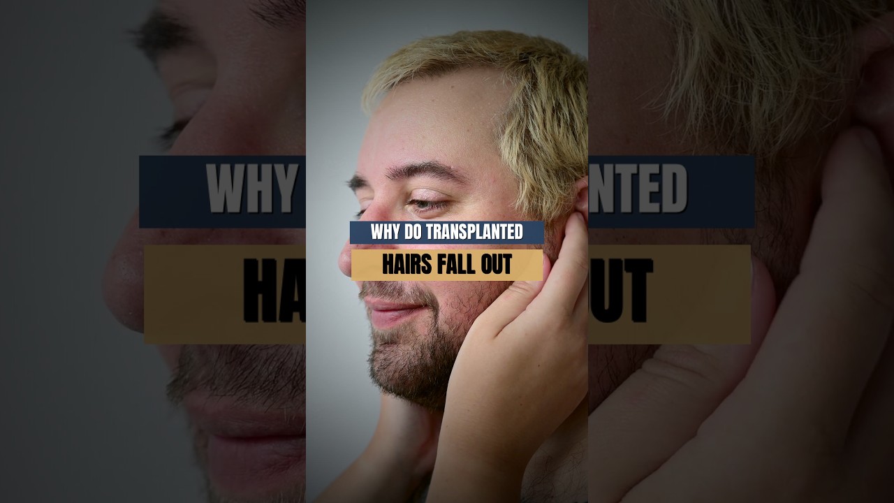 Why Do Transplanted Hairs Fall Out After Surgery?