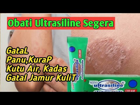 Review ultrasiline salep untuk gatal kulit, panu,kurap,kudis,kutu air