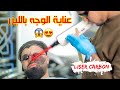 Laser carbon de visage sur dodo vip | عناية الوجه بالليزر .. العلاج الذي يبحث عنه الجميع