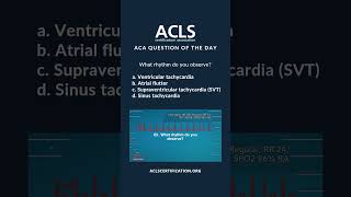 What’s this ECG Rhythm? | ACLS Megacode Challenge #shorts