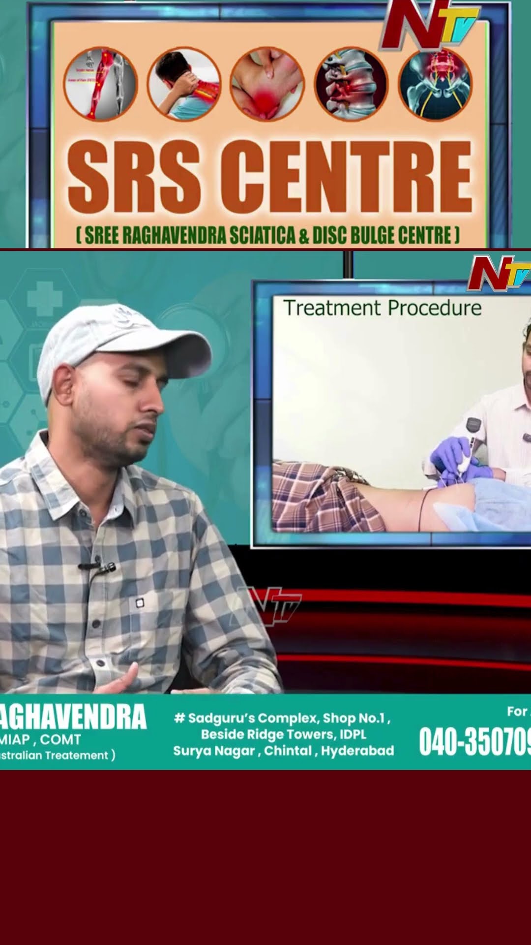 Dry needling treatment అంటే ఏంటి ఎవరు చేయించుకోవాలి? | Dr Machani Raghavendra | SRS Centre | Ntv