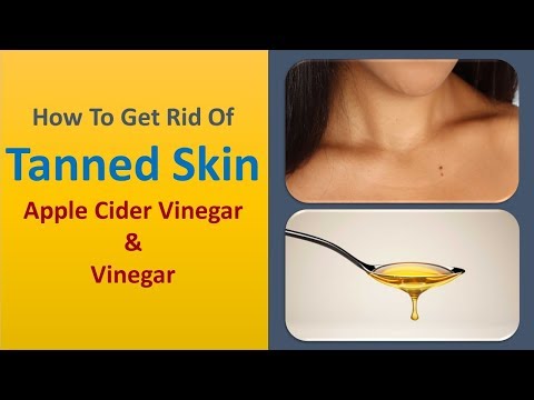 how to get rid of tanned skin naturally - Apple Cider Vinegar & Vinegar