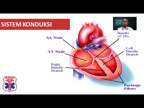 Video: Elektrokardiografi Serial Untuk Mendeteksi Patologi Jantung Yang Baru Muncul Atau Memburuk: Pendekatan Pembelajaran Mendalam