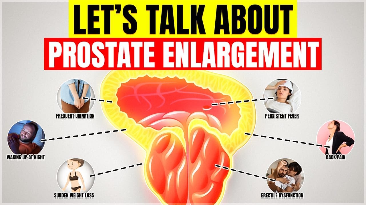 Prostate Warning Add STOP Ignoring PROSTATE HEALTH Warning Signs You Need to Know - YouTube