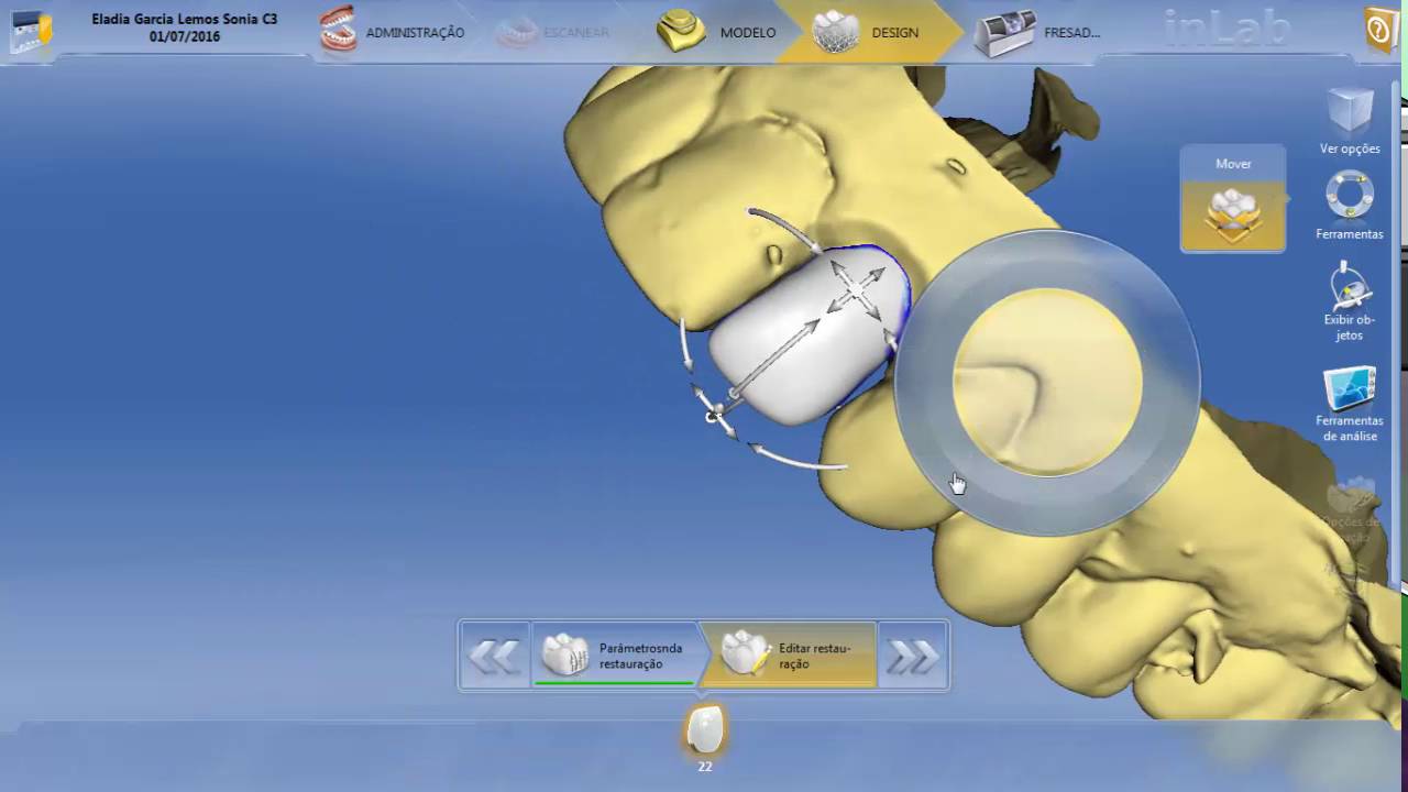 Cad/Cam Cerec Sirona 22 - YouTube