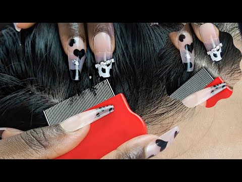 ASMR Fastest Way for a DEEP Nap 😴 ATTENTIVE NITPICKING.