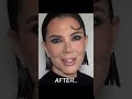 Kris Jenner 2025 Face Reveal 🤯 | Before and After Latest Surgery
