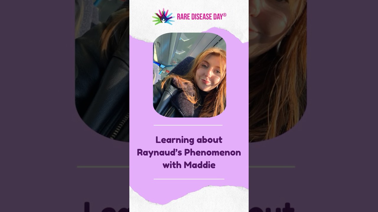 Symptoms of lupus - Learn about Raynaud's Phenomenon