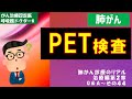 がんのPET検査
