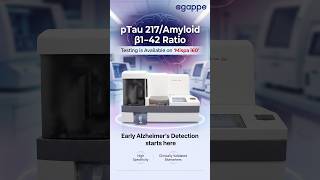 Early Alzheimer’s Detection with pTau217/Amyloid β1-42 Ratio | Mispa i60