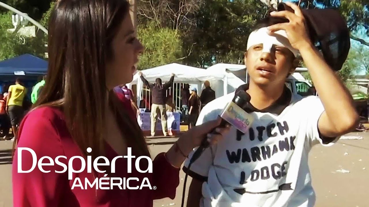 Joven de la caravana migrante termina con 11 puntadas en la frente justiciar