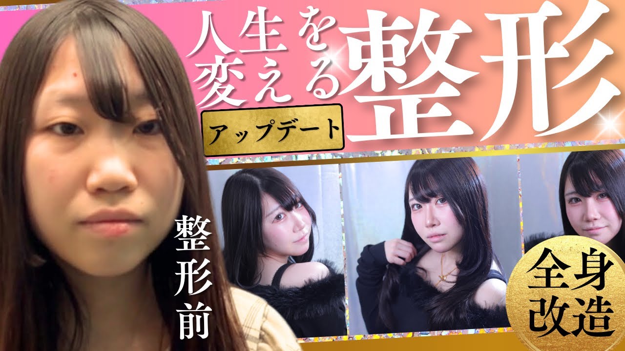 全身整形】人生を変える別人級フル整形【美容外科】 -