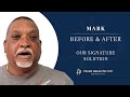 No More Meds, No More Limits: Mark's Back Pain Breakthrough at 58 with Peak Health VIP