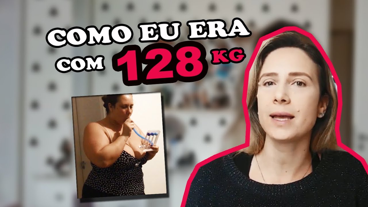 Bariátrica Antes e depois com 60 kg a menos YouTube