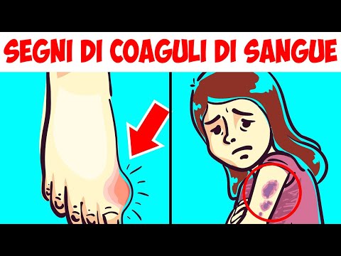 Video: 3 modi per accelerare la coagulazione del sangue