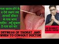 Dry throat .गला खराब होने के 4ऐसे लक्षण जब आपको डॉक्टर के पास जाना चाहिए .क्यु सूखता है गला बार बार