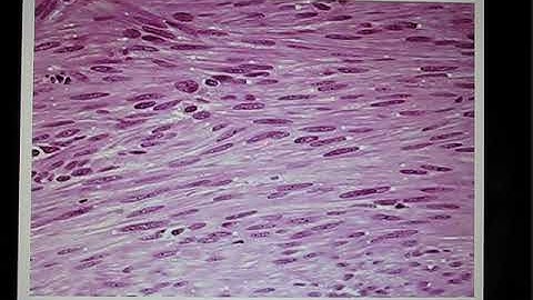 ACC Biol2401 AP I Muscle1 part1