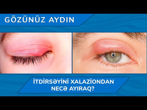 Video: İt niyə tənbəldir?