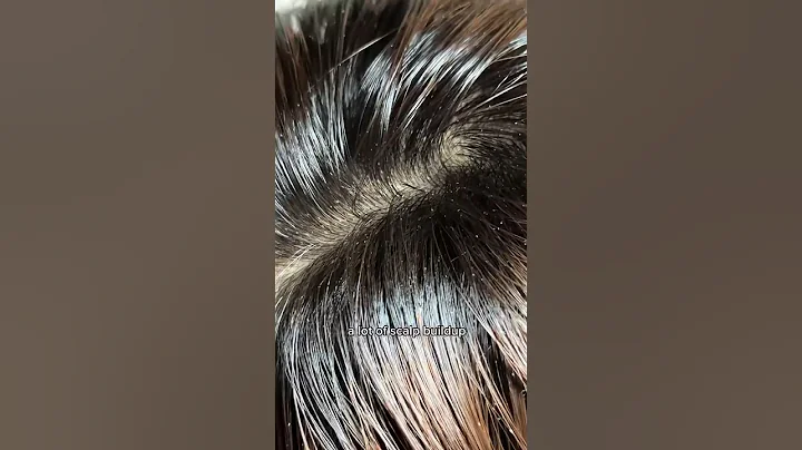 Have you ever tried a scalp scrubber?🤔