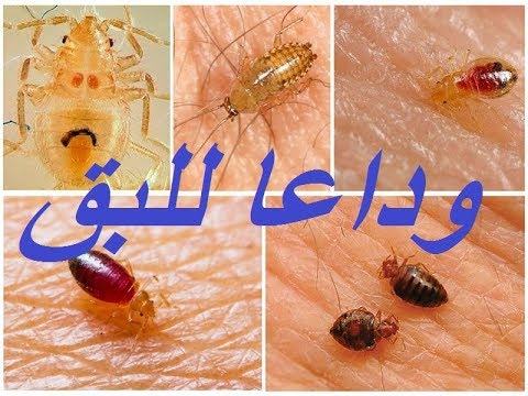 فيديو: خل البق في الشقة: كيف نتخلص منه بالخل وهل يساعد في مقاومة البق؟ كيف تتعامل مع إزالة الحشرات في المنزل؟