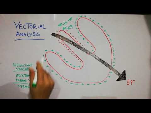 Video CVS physiology 26. cardiac vector, vectorial analysis,... - youtube