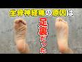 【坐骨神経痛の原因は足裏だった】お尻の痛みや違和感も自分で治す方法