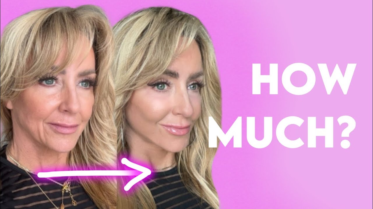 Стоимость подтяжки лица Шален Джонсон 💰 У меня есть чеки.